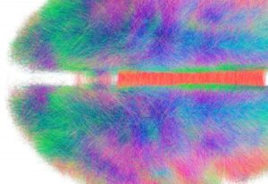 A vividly colored abstract image of the brain.